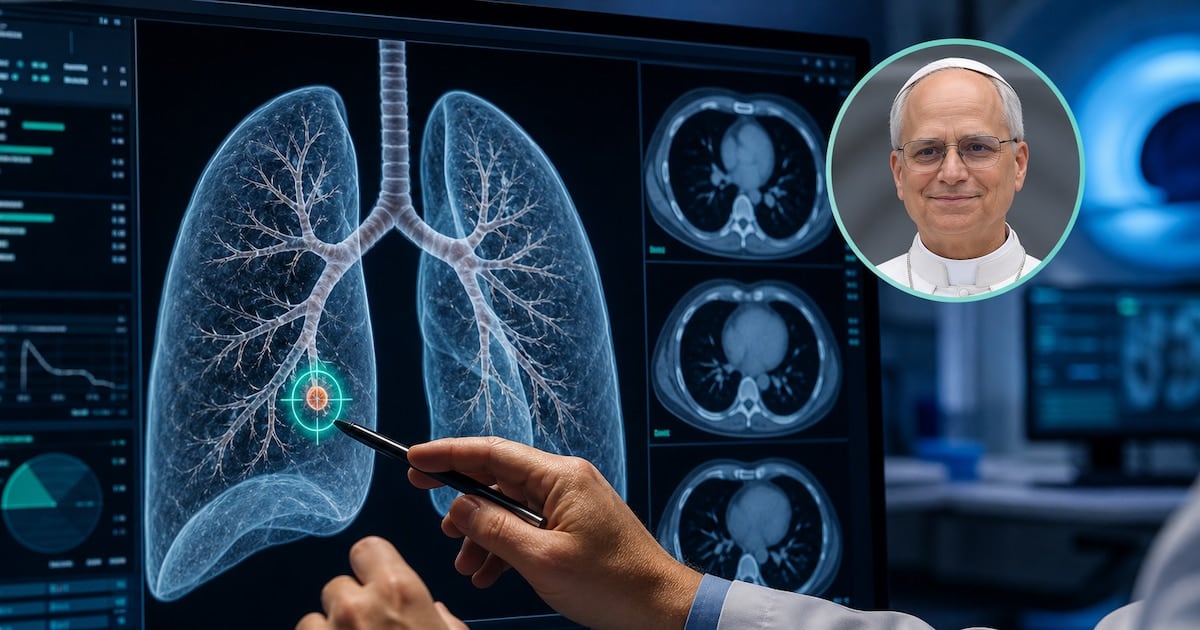 Tres milímetros que se miran con lupa: la decisión médica detrás de operar un nódulo pulmonar diminuto