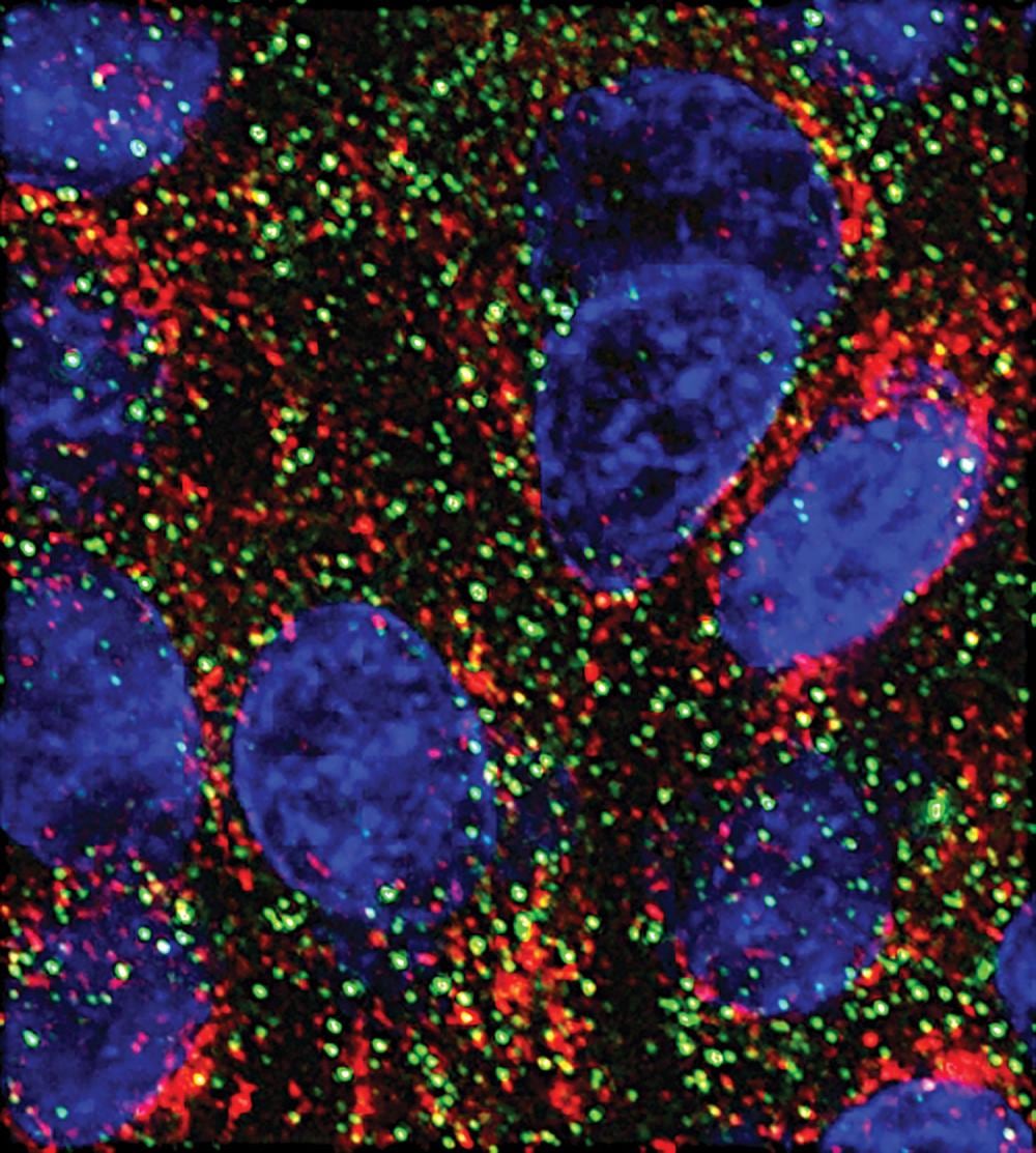 MicroARN frenan el crecimiento de células de cáncer de páncreas en laboratorio